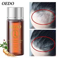 OEDO Tinh chất kích thích mọc tóc ngăn rụng tóc, bóng mượt, không mùi, chiết xuất nhân sâm Hàn Quốc
